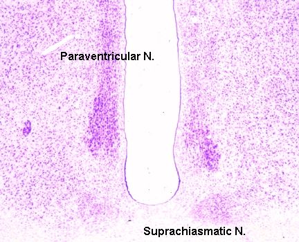 File:HIGHPVN.jpg