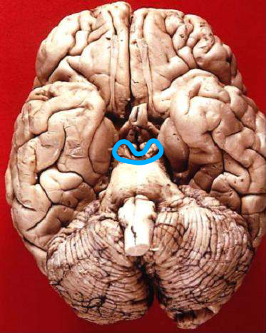 File:Location of Midbrain in inferior view.png