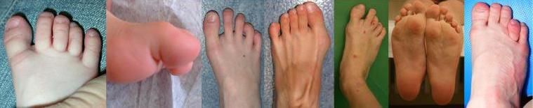 File:Nbs feet2.JPG