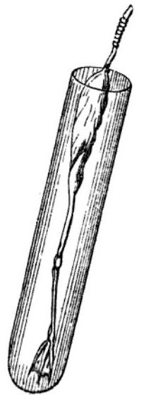 File:Frog's leg galvanoscope.jpg