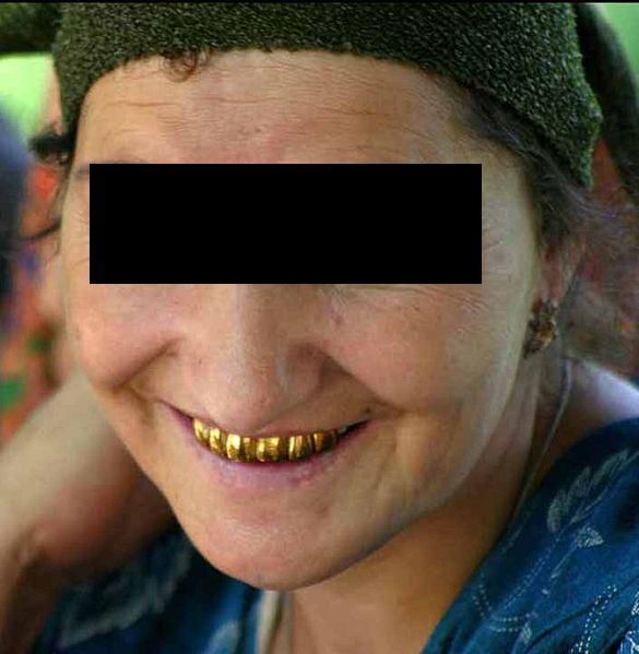 File:Tajikistan gold teeth new.jpg