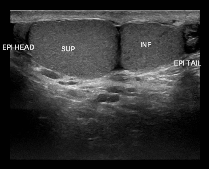 File:Tritestes ultrasound.jpg