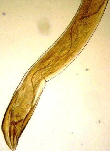 File:Gongylonema pulchrum nematode from man Figure 2c.jpg