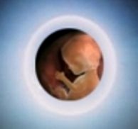 Bowman embryogenetic resurrection