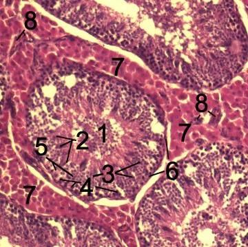 File:Testicle-histology-boar-2.jpg