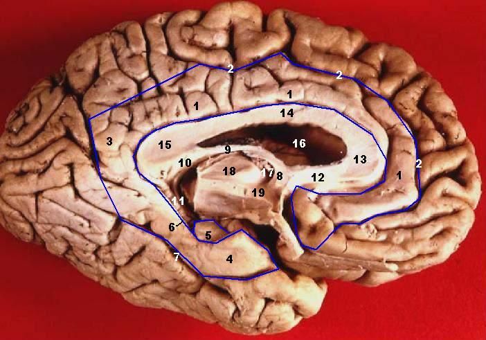 File:Human brain inferior-medial view description 3.JPG