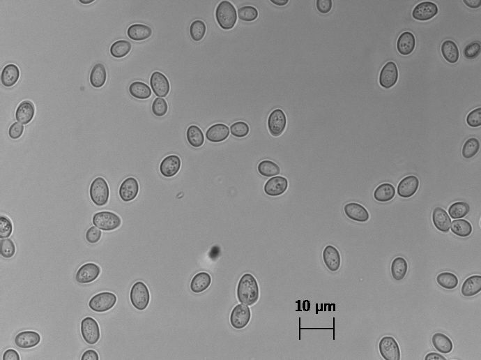 File:Zygosaccharomyces bailii cells.jpg