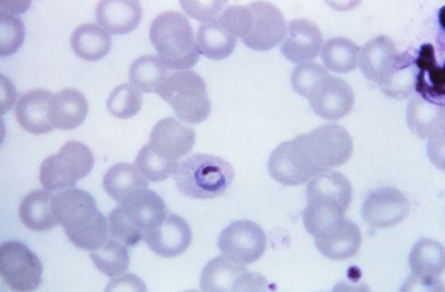 File:Plasmodium ovale 01.png