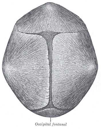 File:Trigonocephaly.png