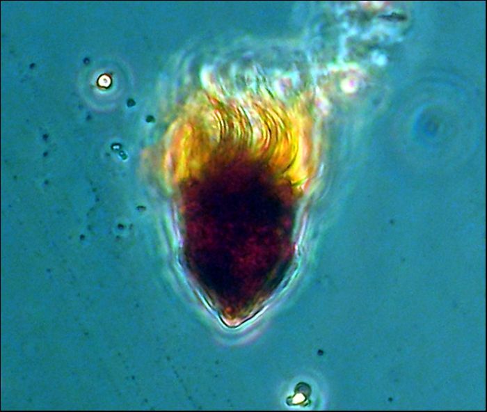 File:643 oligotrich-ciliate.jpg