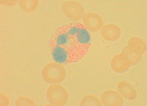 File:Eosinophil.jpg