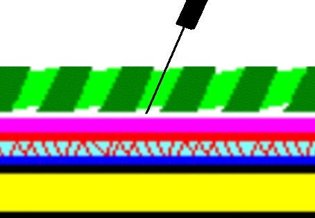 File:Epiduraldiagram.jpg