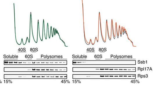 File:Polysomes.jpg