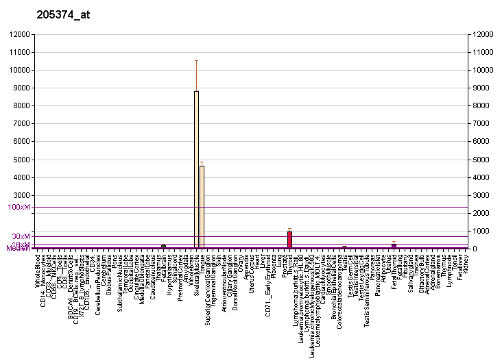 File:PBB GE SLN 205374 at fs.png