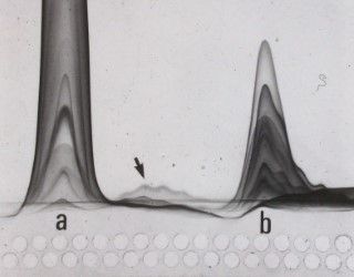 File:FusedrocketimmunoelectrophoresisHuSeonConA 01.jpg