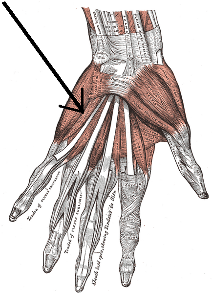 File:Musculusflexordigitiminimibrevismanus.png