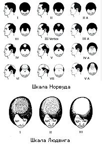 File:Alopecia scales.jpg