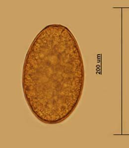 File:F. magna egg.jpg