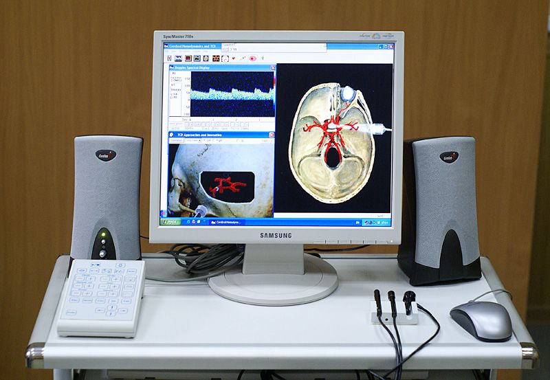 File:Doppler ultrasound analyzer of blood velocity.jpg