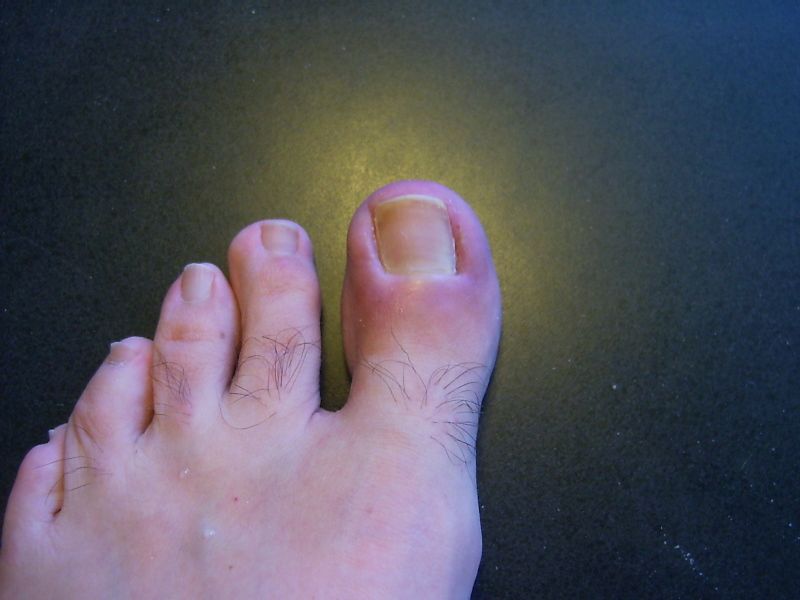 File:Toe (47).JPG