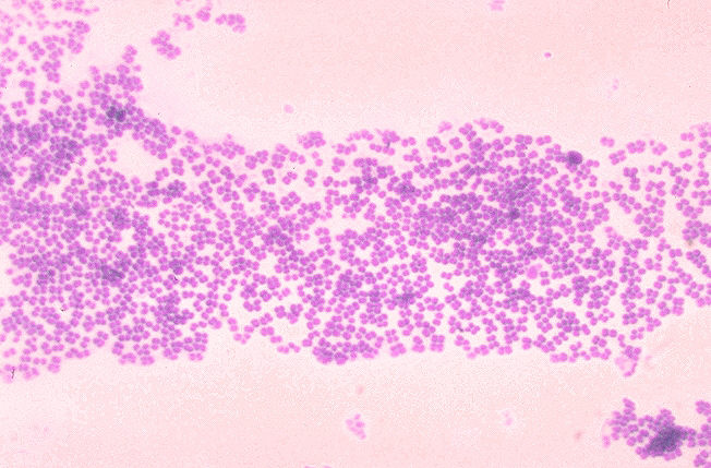 File:Micrococcus mucilaginosis 01.png