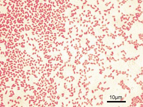 File:Pseudomonas aeruginosa Gram.jpg