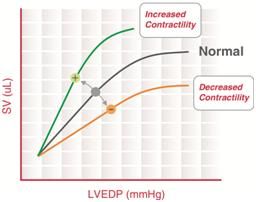 File:Frank-Starling Curve.jpg