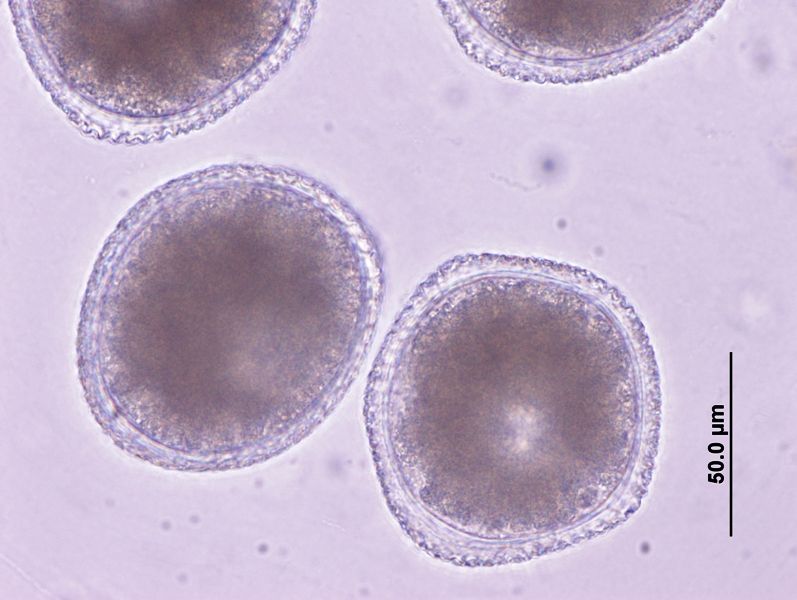 File:Fresh toxocra eggs close-up.jpg