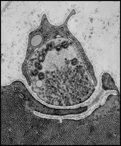 File:HeuserNeuro.jpg