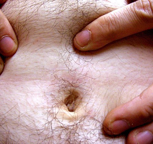 File:Navel lint.jpg