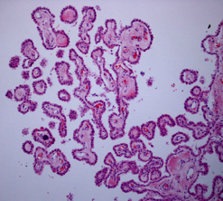 File:Choroid Plexus Histology 40x.png