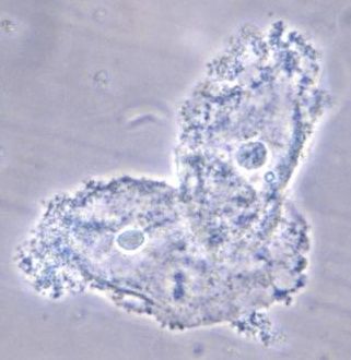 File:Clue cells - CDC PHIL 3720.jpg