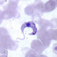 File:Trypanosoma cruzi B.jpg