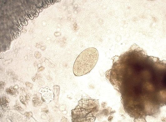 File:Egg of Fasciola hepatica 08G0041 lores.jpg