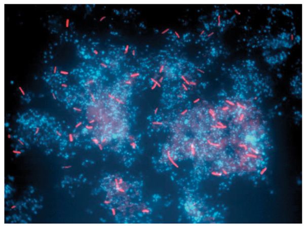 File:FISH-analyses-of-Sulfobacillus-rods-in-B-drift-Weir-biofilm-on-January-2001.jpg