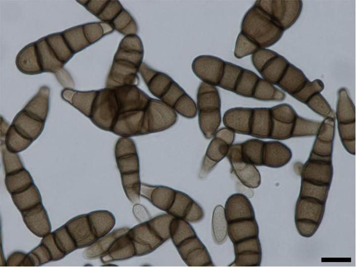 File:Alternaria brassicicola conidia2.jpg