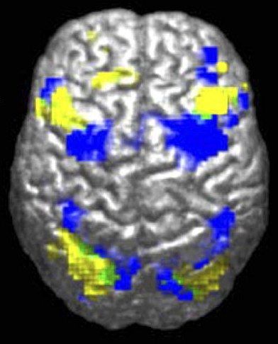 File:Powell2004Fig1A.jpeg