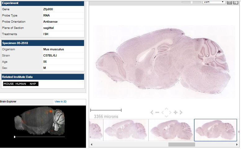 File:Mouse Brain ZNF800 Expression .png