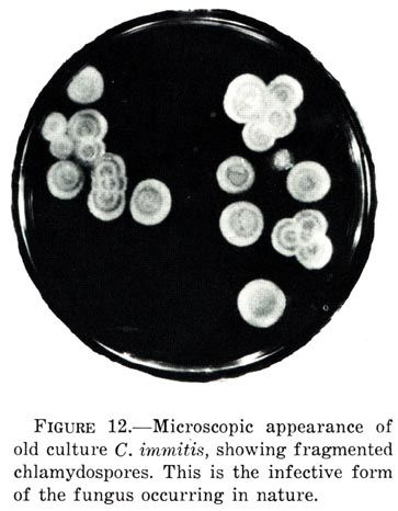 File:Coccidioides immitis microscopy.jpg