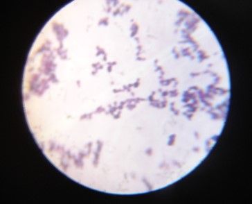 File:Candida albicans under microscope.jpg