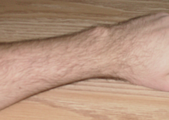 File:Human wrist.png