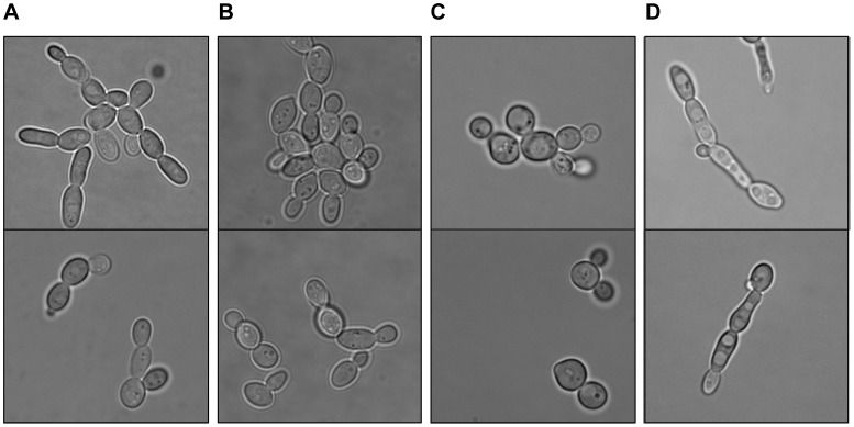 File:Zygosaccharomyces rouxii.jpg