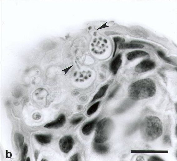 File:Chytridiomycosis2.jpg