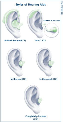 File:HearingAidTypes.jpg