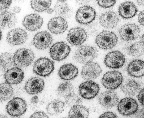 File:HIV-1 Transmission electron micrograph AIDS02bbb lores.jpg