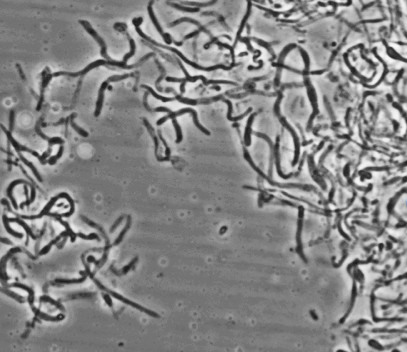 File:TuricibacterCells2.png