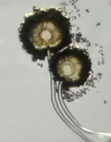 File:Aspergillus niger uner the Foodscope 2.jpg