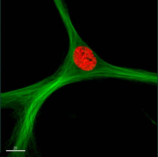 File:HMSC MAP4GFP H2BRFP.jpg