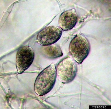 File:Sporangiospores.jpg