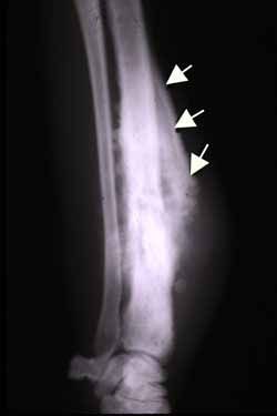 File:Codman triangle 2014-01-29 21-07.jpeg